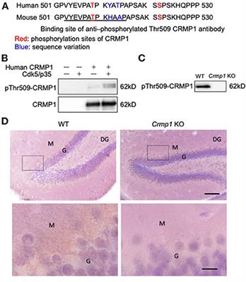 Phosphorylated CRMP1, axon guidance protein, is a component of spheroids and is involved in axonal pathology in amyotrophic lateral sclerosis